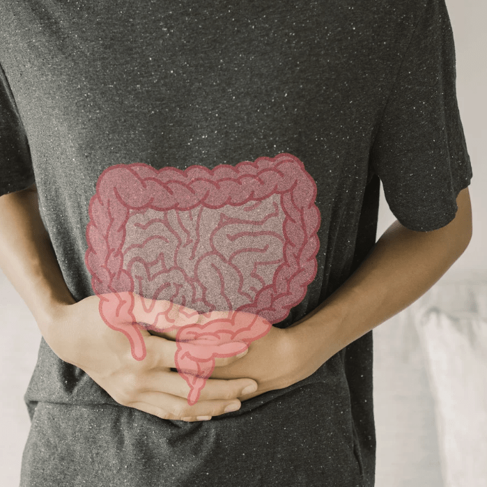 Pourquoi certains aliments “autorisés” FODMAP te font quand même mal au ventre ?